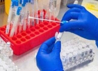 ΠΟΥ: Ο κίνδυνος για τον άνθρωπο από τη γρίπη των πτηνών παραμένει χαμηλός μετά τον πρώτο θάνατο ασθενούς στις ΗΠΑ