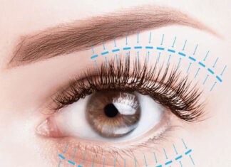 Βλεφαροπλαστική: Πώς ανανεώνει το πρόσωπο