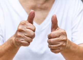 Αρθρίτιδα αντίχειρα: Πότε εμφανίζεται και πως αντιμετωπίζεται