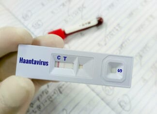 Χανταϊός: Ένα σοβαρό ζήτημα δημόσιας υγείας