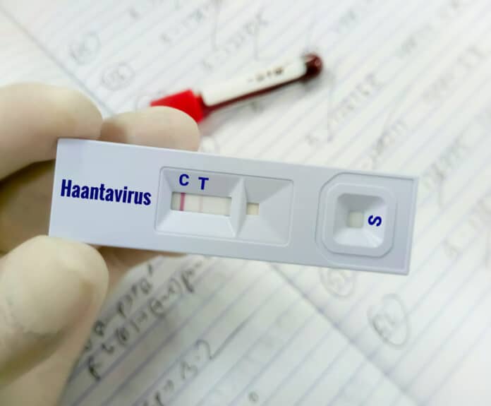 xantaios